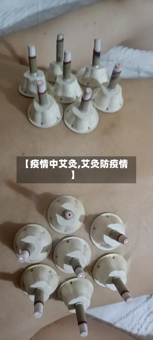【疫情中艾灸,艾灸防疫情】